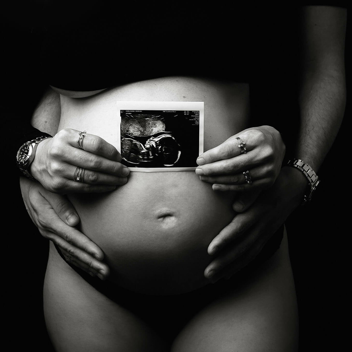 An image of a pregnant woman holding an ultrasound.